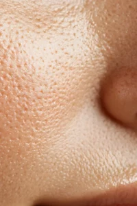 textura irregular y poros abiertos