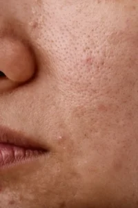 rutina facial completa