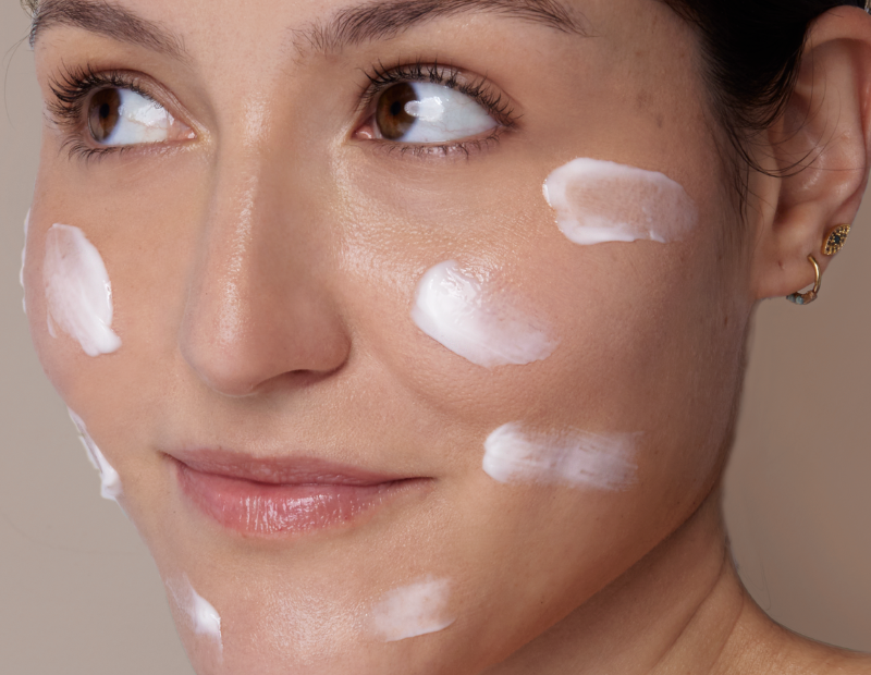 Por qué tu acné vuelve aunque hagas skincare